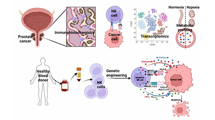 Characterization of Natural Killer cells in Prostate Cancer and Therapeutic Interventions