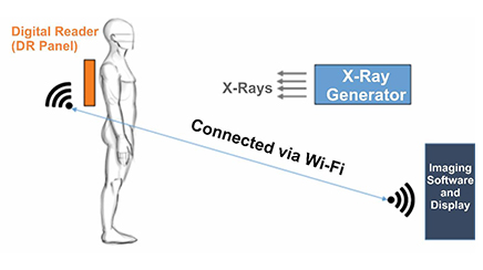 Developing affordable and AI-enabled handheld X-ray device for Tuberculosis Diagnosis